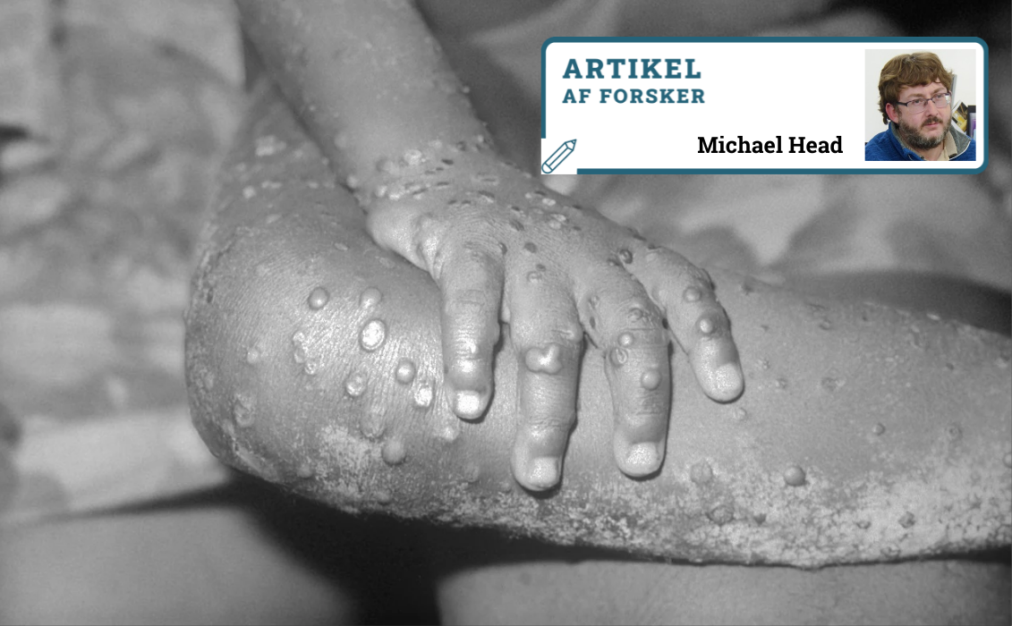 abekoppe-udslæt