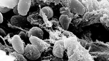y pestis pest bakterie