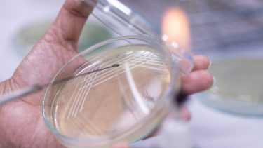 Gensplejset gær biologi kræftmedicin