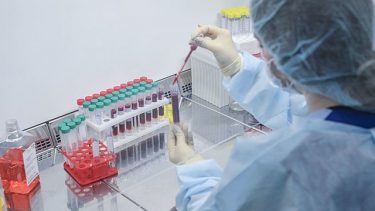 immunterapi t-celle autoimmun sygdom gennembrud medicin behandling lupus
