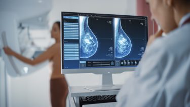 Mammografi af bryst