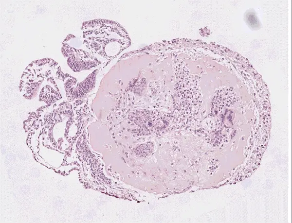 abeembryon