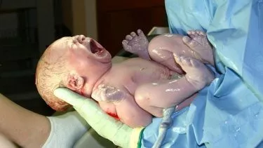 Nyfødt, skrigende baby, der stadig er dækket i fosterfedt, som bliver holdt af en person med plastikhandsker og blå papirkittel