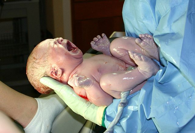 Nyfødt, skrigende baby, der stadig er dækket i fosterfedt, som bliver holdt af en person med plastikhandsker og blå papirkittel