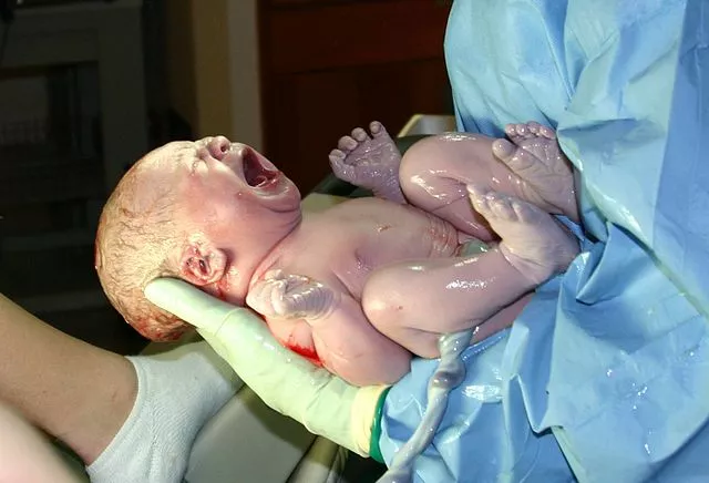 Nyfødt, skrigende baby, der stadig er dækket i fosterfedt, som bliver holdt af en person med plastikhandsker og blå papirkittel