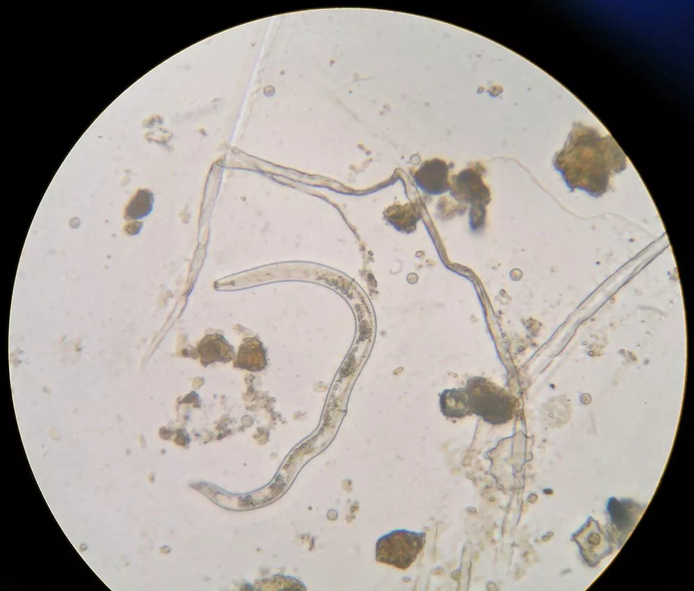 Nematode i mikroskop