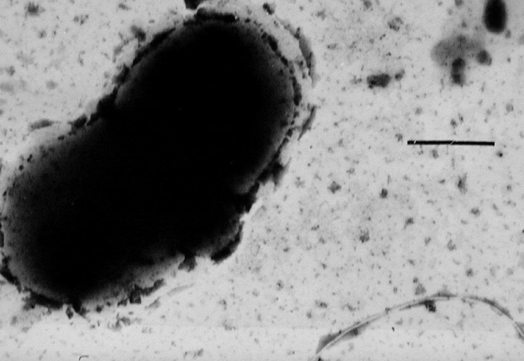 Desulfovibrio-bakterie