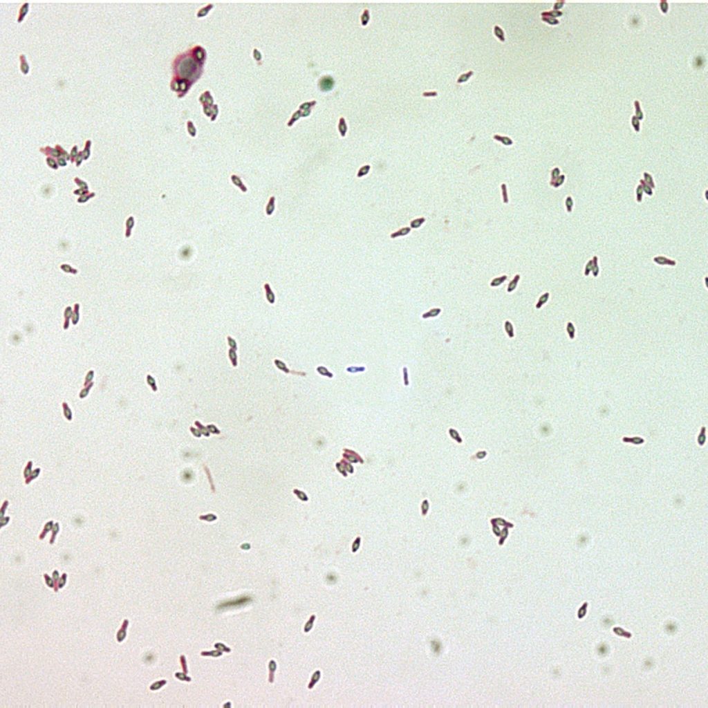 Botulinum toksinet set under et mikroskop
