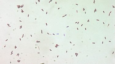 Botulinum toksinet set under et mikroskop