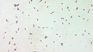 Botulinum toksinet set under et mikroskop