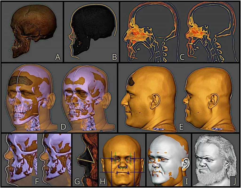 3D rekonstruktion af middelaldermand