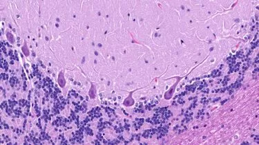 Purkinjeceller fra lillehjernen