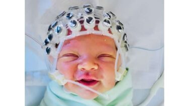 Spædbarn med EEG-måler på hovedet