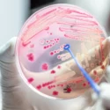 En biologs hånd, der holder en petriskål med bakterier