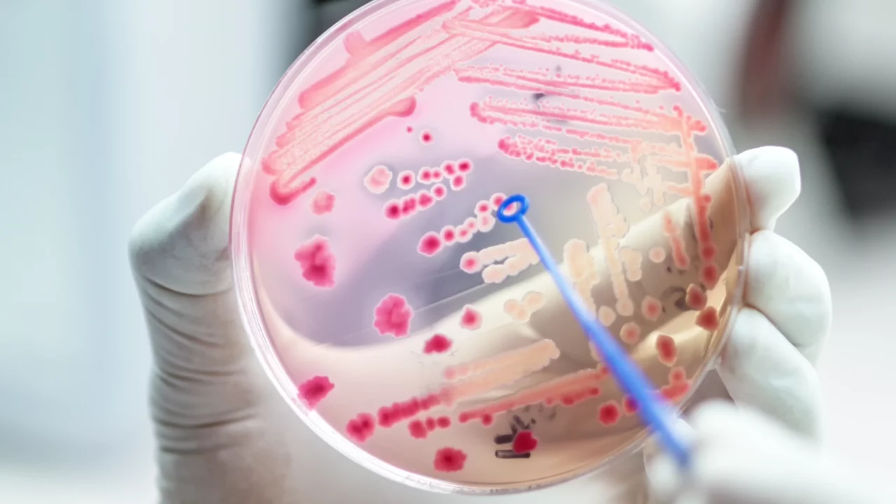 En biologs hånd, der holder en petriskål med bakterier