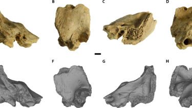Fossilerne af neandertaleren med Downs syndrom
