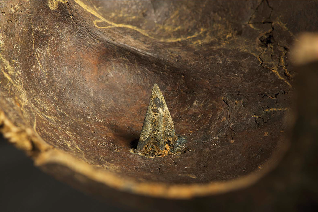 Pilespids af bronze, der har gennemboret et kranie