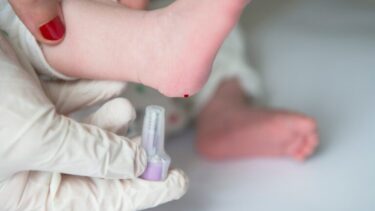 Baby får taget en hælprøve