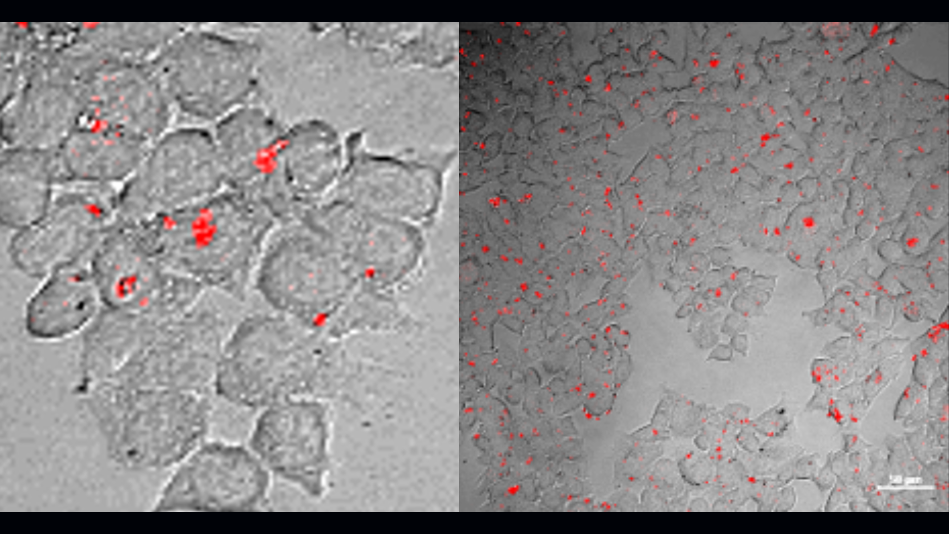 Det røde lys viser RNA-molekyler inde i levende celler. Lyset gør det muligt at følge molekylernes adfærd. (Foto: Pratik Shah)
