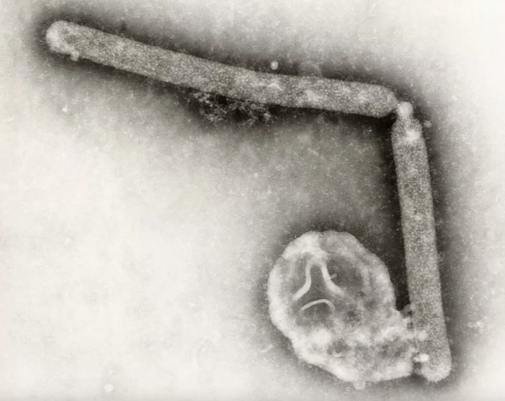 H5N1-virussen set under et mikroskop