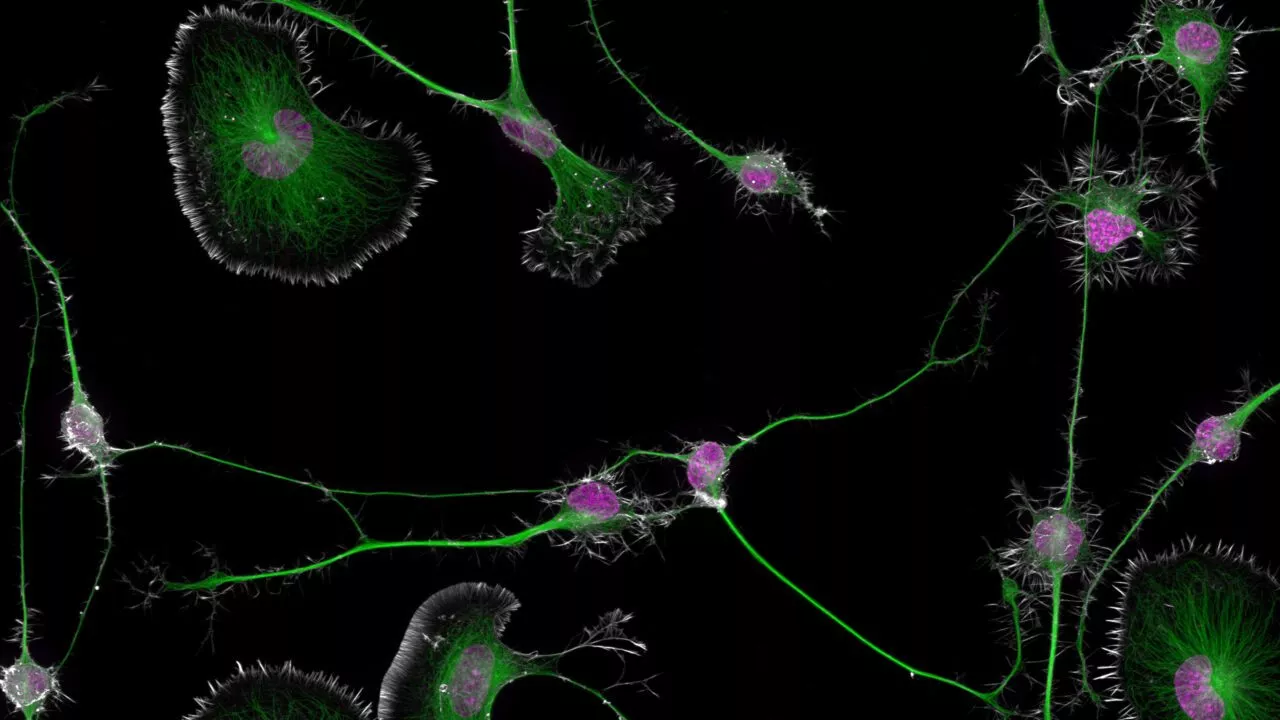 Vinderbilledet forestiller tumorceller i en mus’ hjerne og er taget af Dr. Bruno Cisterna og Dr. Eric Vitriol fra Augusta University. (Foto: Bruno Cisterna og Dr. Eric Vitriol/Nikon)