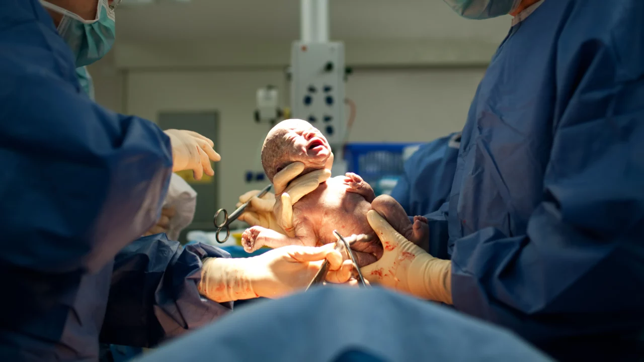 En nyfødt baby holdes af læger efter kejsersnit