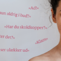 Kvinde med akne og de fordomme, hun møder
