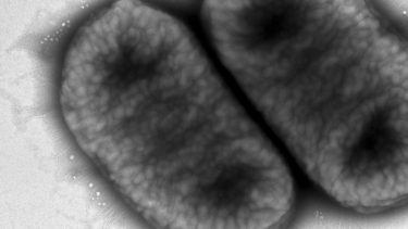 K. pneumoniae i mikroskop