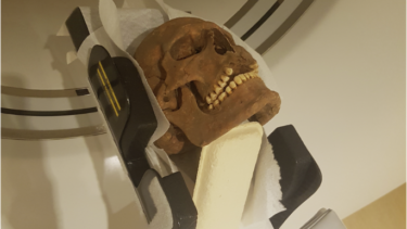 Vikingekranium, der bliver scannet.