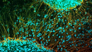 Stamceller i farvelagt mikroskopi