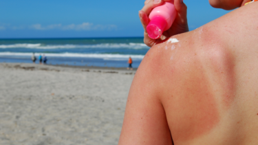 Kvinde på stranden - hun skal til at smøre solcreme på skulderen