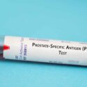 Nærbillede af et reagensglas med rød hætte, fyldt med blod, mærket Prostata-specifikt antigen (PSA)