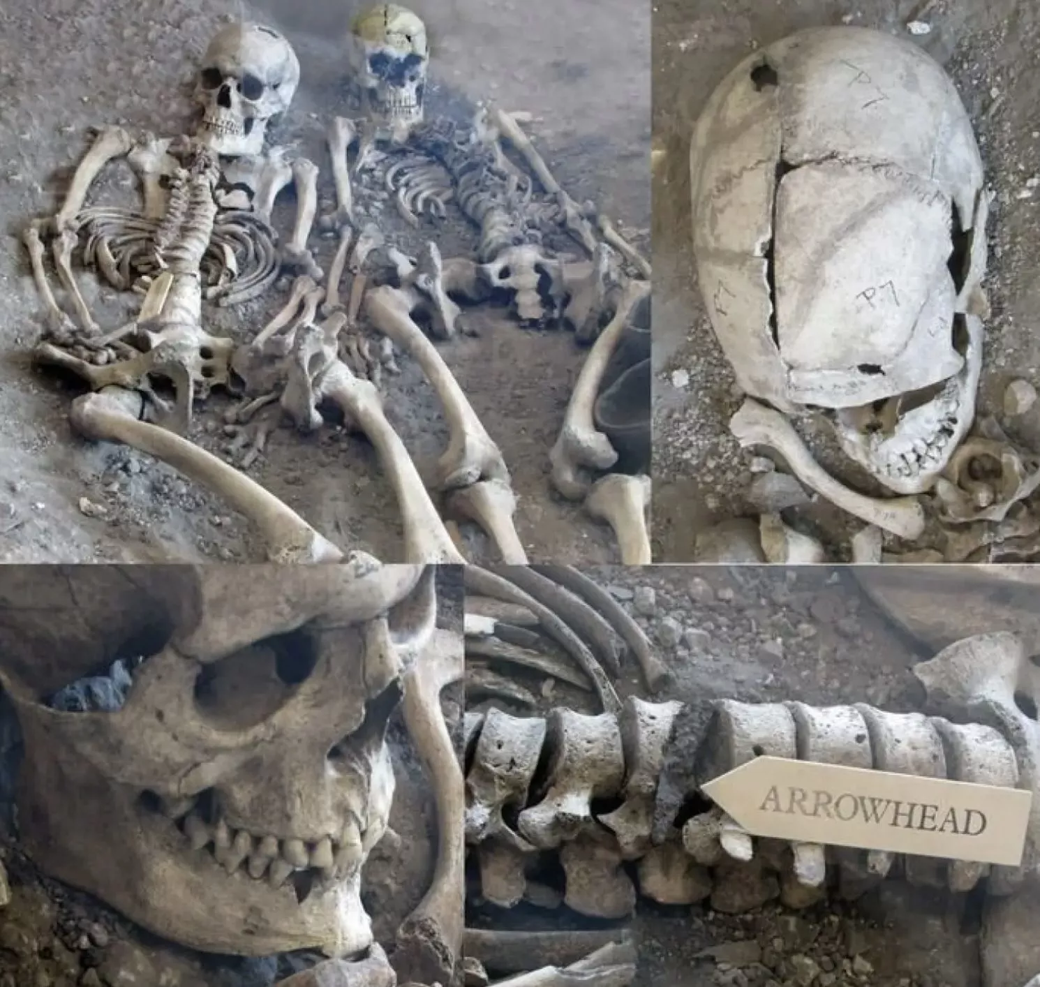 To af skeletterne, der blev udgravet i 1930'erne. Begge bærer spor efter skader fra våben. Det ene skelet har en spidsen af et pil i rygsøjlen, hvilket er blevet tolket som et projektil fra en romersk ballista, en slags kastevåben. 