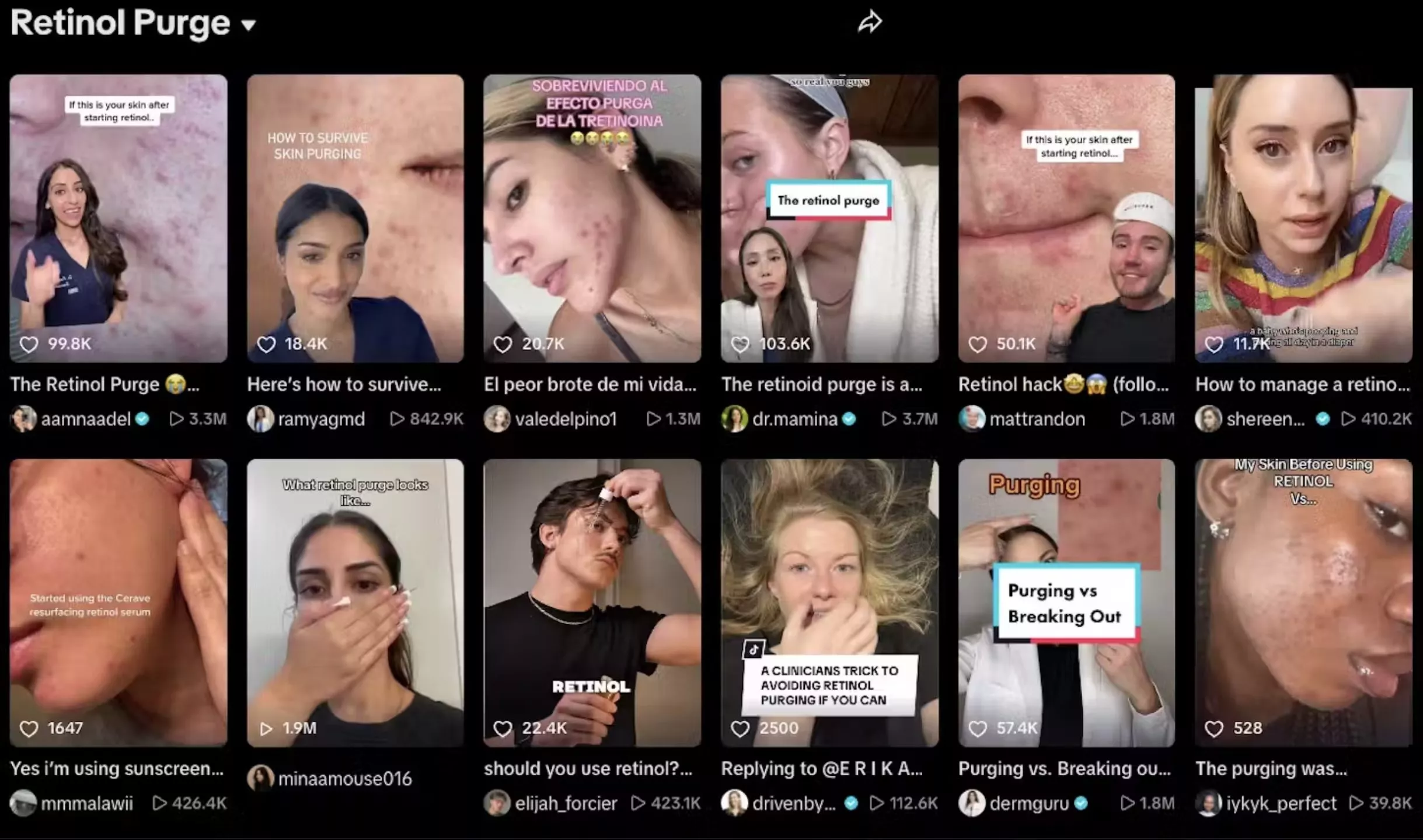Fotocollage af såkaldt 'purging' ved brug af retinol.