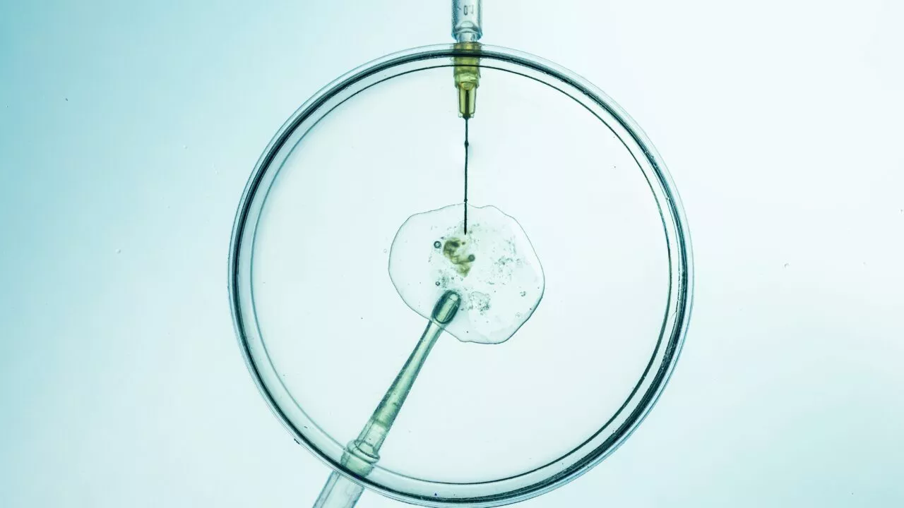 Et nærbillede af en petriskål med en celle i midten. En pipette og en sprøjtenål er indsat i skålen, hvilket antyder et laboratorium eller et videnskabeligt eksperiment, muligvis relateret til IVF eller celleforskning.