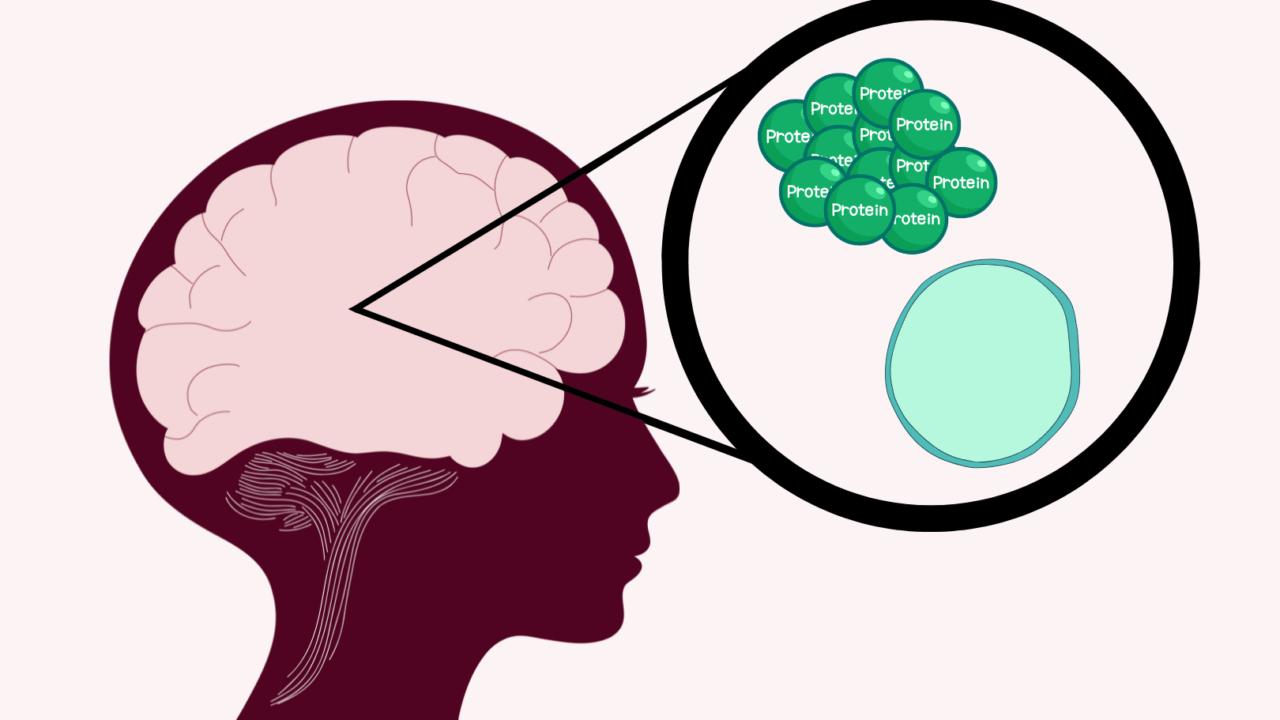 En sideprofil af et menneskehoved med en hjerne illustreret indeni. En indzoomet cirkel viser grønne proteinmolekyler i nærheden af en blå celle, hvilket tyder på proteiner i hjernen eller i en cellulær sammenhæng.