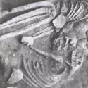 Et sort-hvidt foto af et delvist udgravet menneskeskelet, der ligger på siden med bøjede arme og ben. Nogle knogler, herunder kraniet, ser ud til at være brækket eller knækket. Skelettet er omgivet af jord.