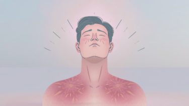 Illustration af en person med kort mørkt hår, lukkede øjne og et roligt udtryk. Bryst og skuldre er røde og solbrændte med synlig irritation på en blød, pastelfarvet baggrund.