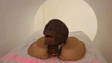 Et mumificeret hoved hviler på et CT-scannerbord, støttet af skumpuder, med røde styrelasere og scannerens cirkulære åbning synlige i baggrunden.