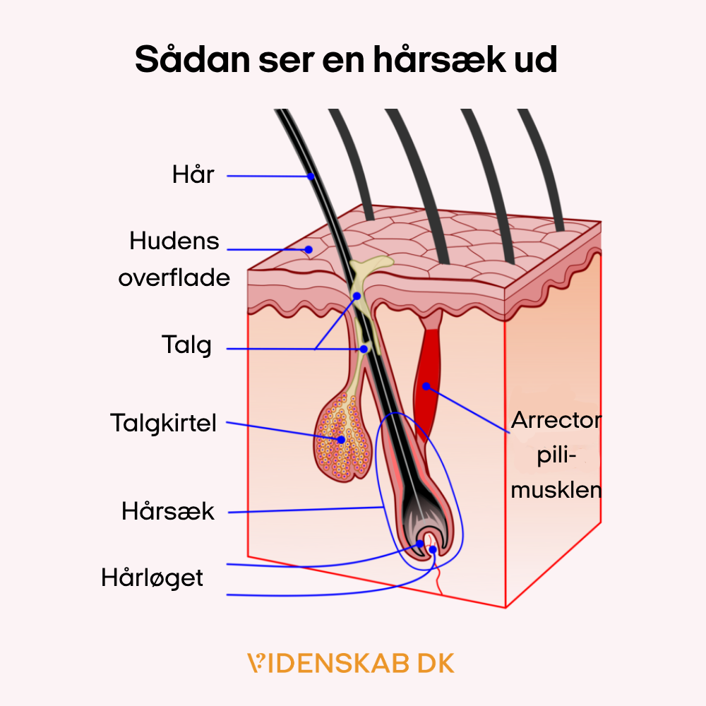 Et diagram af en hårsæk i huden, markeret på dansk med dele som hår, hudoverflade, talg, talgkirtel, hårsæk, hårknold og arrector pili muskel.