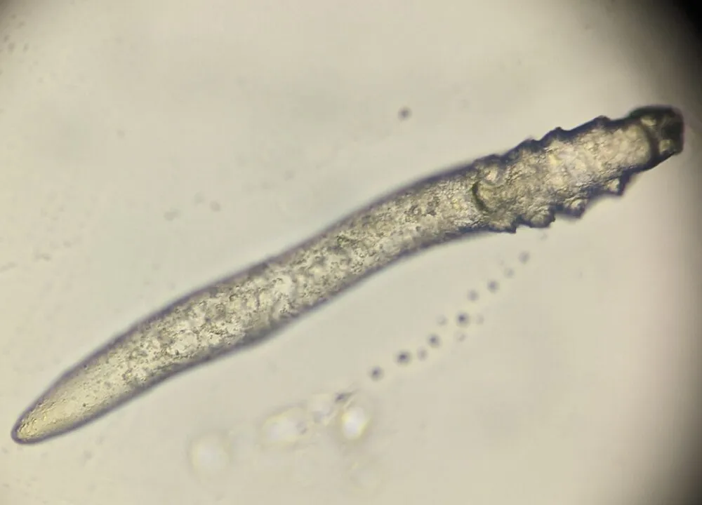 Mikroskopisk billede af en gennemskinnelig, ormelignende organisme med en tilspidset ende og en rillet, segmenteret krop, set på en lys baggrund.