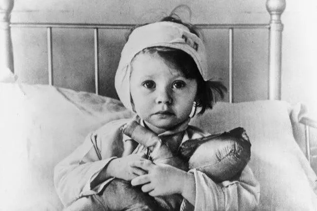 Et lille barn med et bandage om hovedet sidder på en seng iført pyjamas og holder et krammedyr, mens det ser alvorligt ind i kameraet. Billedet er i sort-hvid.