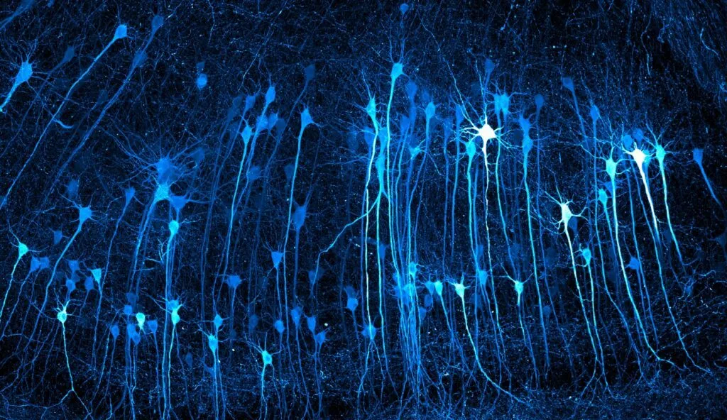 Mikroskopisk billede af neuroner med lysende blå cellekerner og forgrenede aksoner på en mørk baggrund.