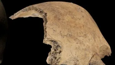 Et nærbillede af et fragment af et menneskekranium, der viser knoglens porøse struktur indvendigt.