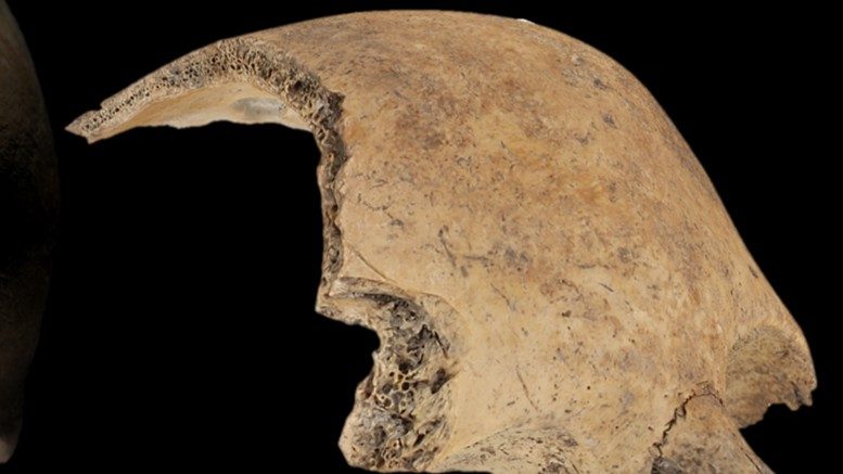 Et nærbillede af et fragment af et menneskekranium, der viser knoglens porøse struktur indvendigt.