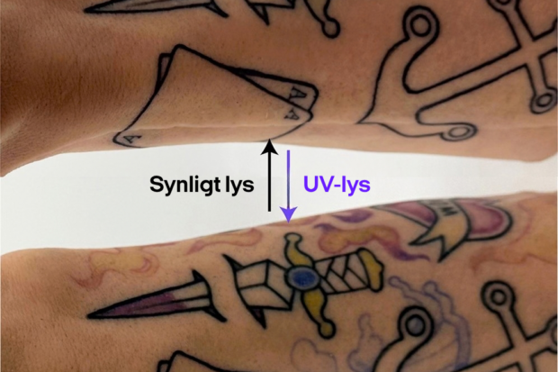Sluk for tussen hos mormor: Ny opfindelse gør tatoveringer usynlige
