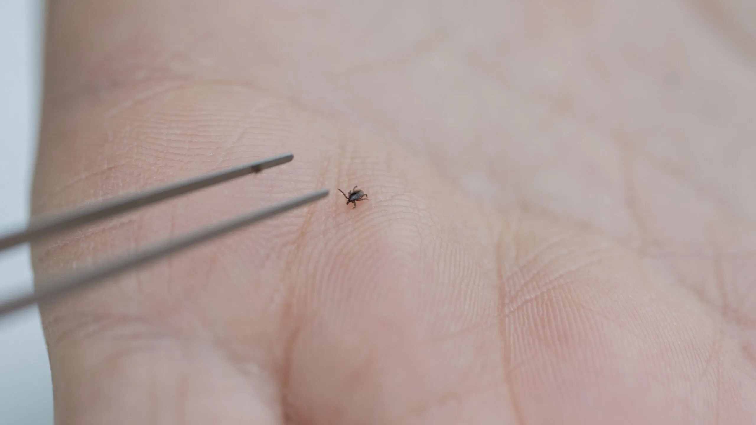 En flåt på en persons håndflade, som en metalpincet nærmer sig.